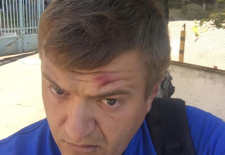 У Херсоні невідомі побили активіста і журналіста Сергія Нікітенка