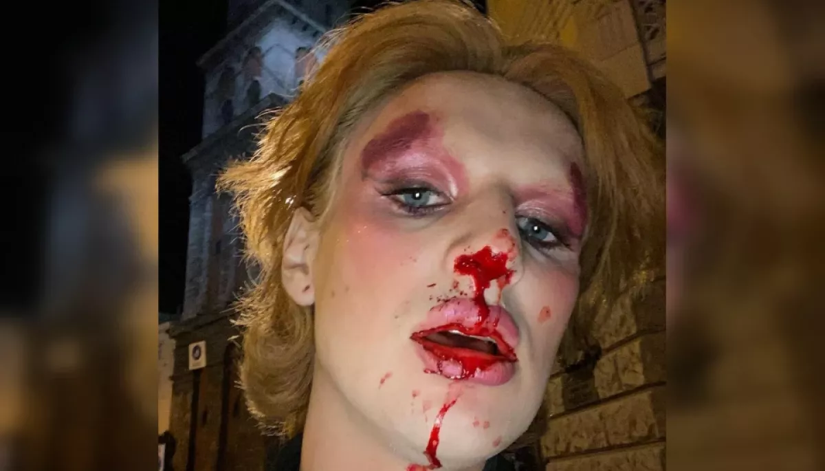 У центрі Львова побили трансгендерну військову. Поліція відкрила справу, нападник попросив вибачення