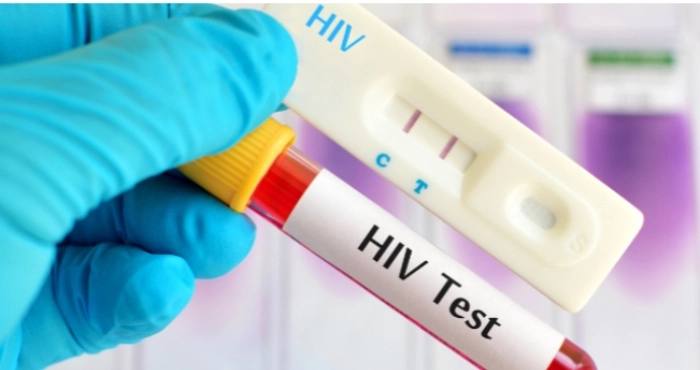 В Україні з ВІЛ живе близько 245 тисяч людей, але кожен може безоплатно протестуватися поруч із домом